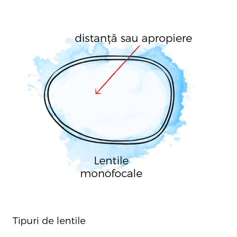 lentile monofocale